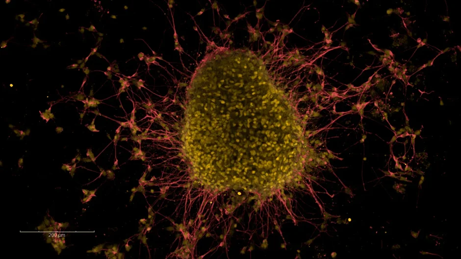 Immunofluorescence characterization of midbrain organoids. Credit: Filippo Cipriani, Ph.D.