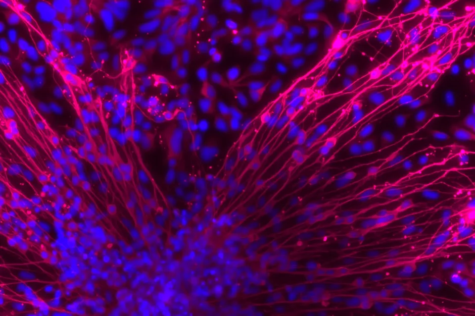 Neurons from induced pluripotent stem cells.