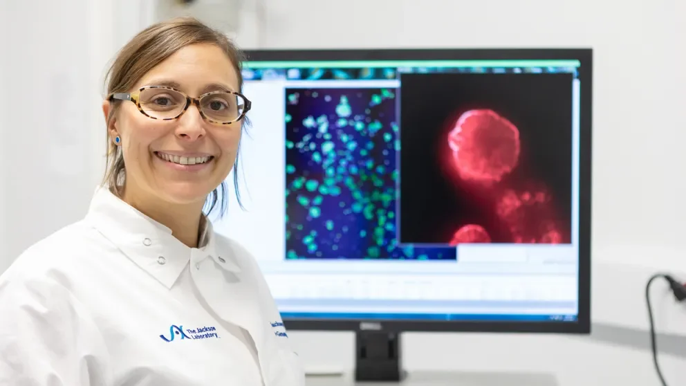 Characterizing endometriosis, cell by cell
