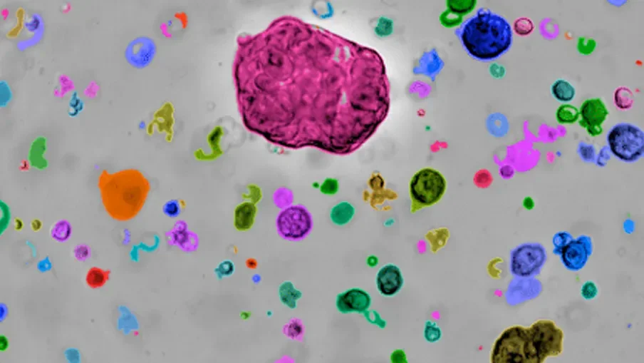 Ovarian cancer tumor organoids.