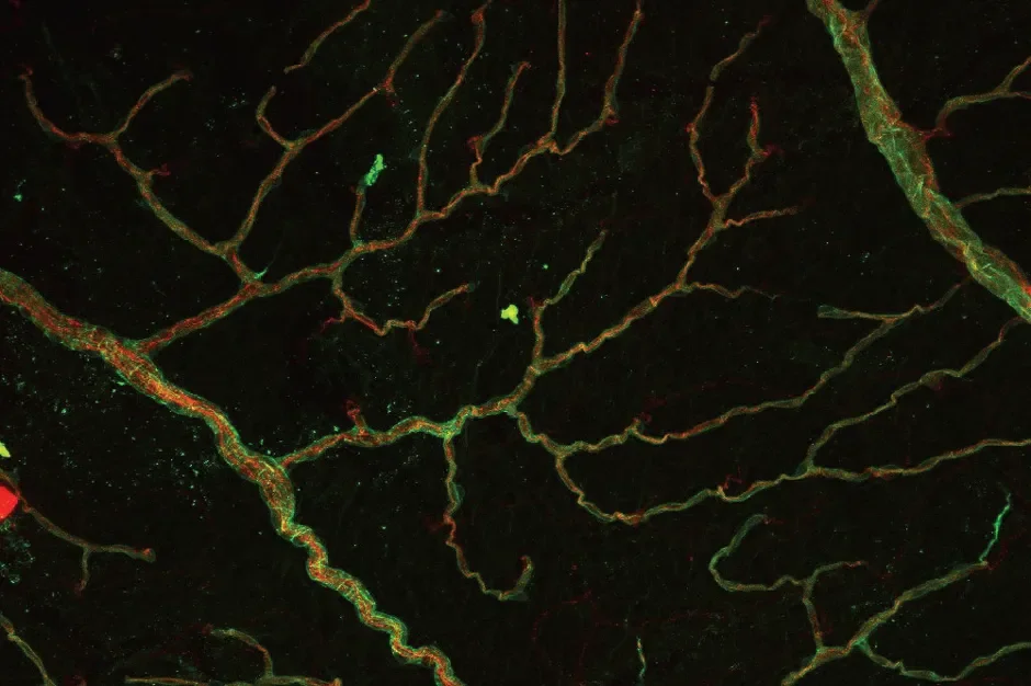 A retinal scan of a young mouse with a common mutation called MTHFR677C>T, which is linked to Alzheimer’s disease risk, shows disease-like blood vessels that are twisted and irregular.