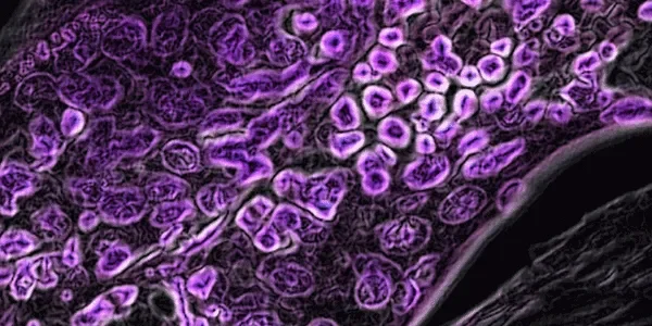 Helping doctors find the best treatment for cancer