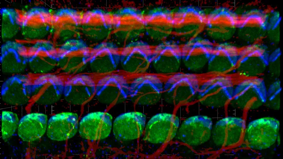 Mechanisms of sound perception