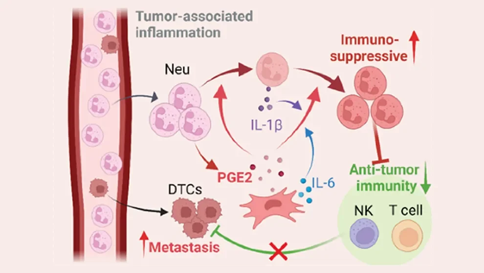Multiple roles for mesenchymal cells in lung metastasis of breast cancer