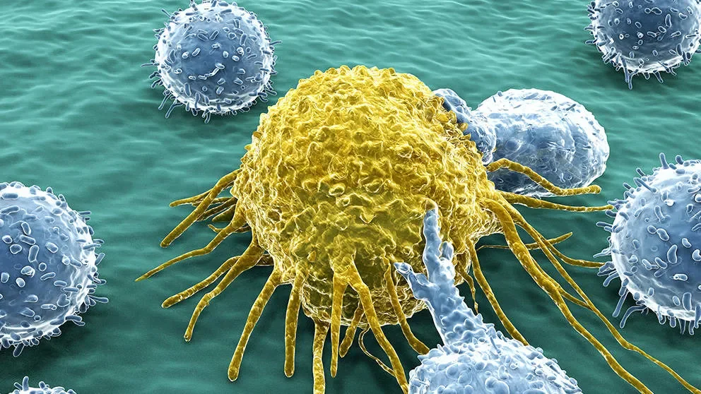 The Next Big Thing in Cancer Modeling: Patient-Derived Xenografts in Humanized NSG Mice