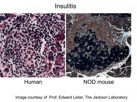 Uncovering the basis of type 1 diabetes using immunodeficient mouse models