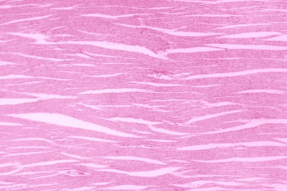 Battle of the sexes: What does it mean for heart health?