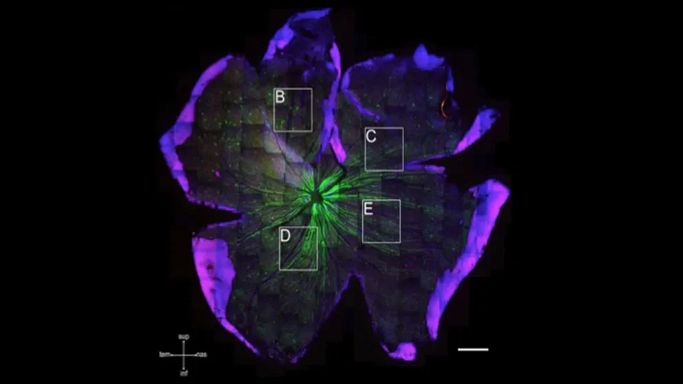 JAX researchers provide clearer view of glaucoma processes