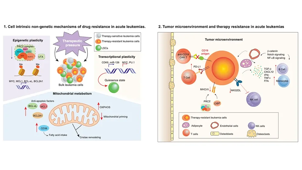 Exploring the nongenetic drivers of acute leukemia drug resistance