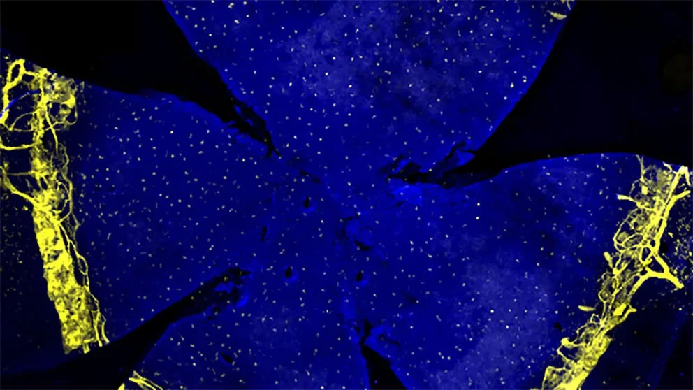 All eyes on Alzheimers disease research