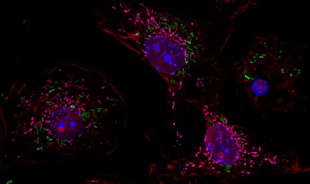 Why are patients with mitochondrial disease more susceptible to infections? New JAX study finds the answer