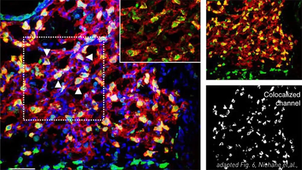 Mouse lung progenitor cells differentiate along all epithelial lineages using new 3D culture method