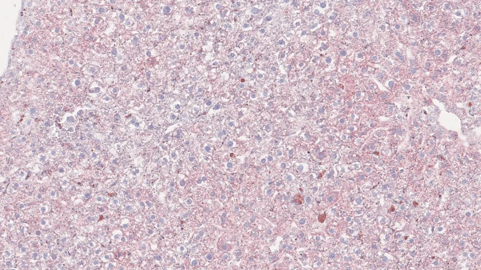 Microscope image of mouse liver tissue treated by editing the PEX1 gene, which causes Zellweger spectrum disorder (ZSD).