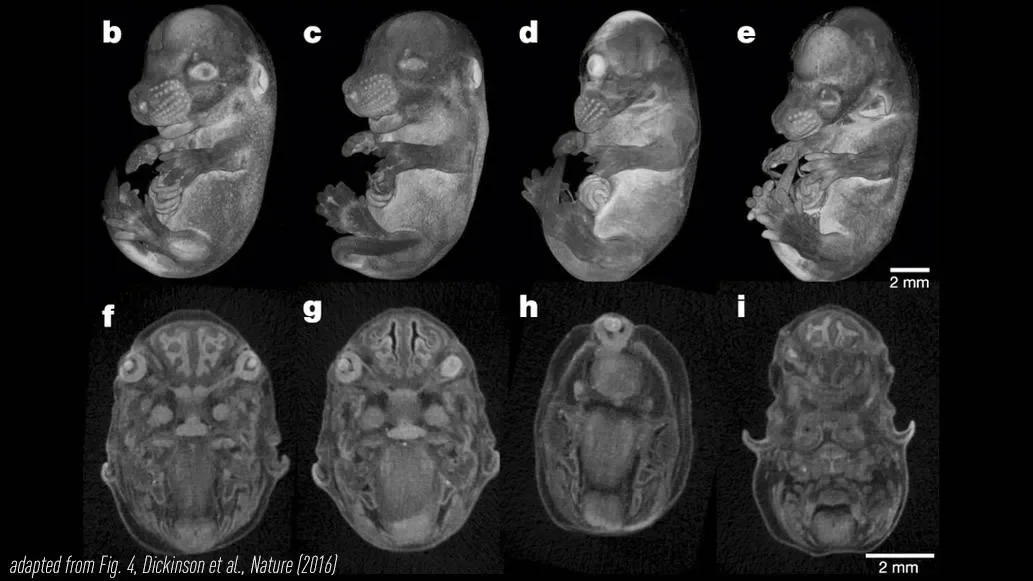 Genes essential to life are enriched for human disease genes, large-scale mouse phenotyping study shows