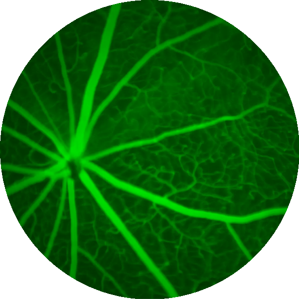 New study uncovers how genes influence retinal aging and brain health