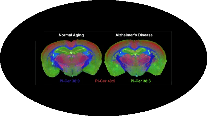 Exploring brain plasticity with single-cell precision