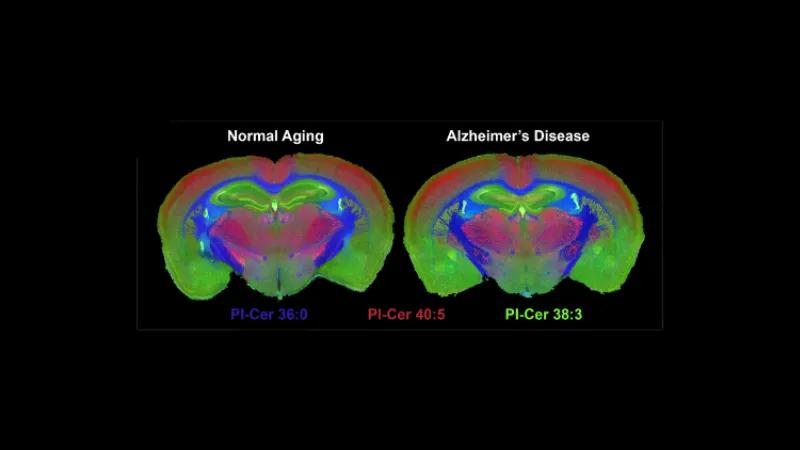 Exploring brain plasticity with single-cell precision