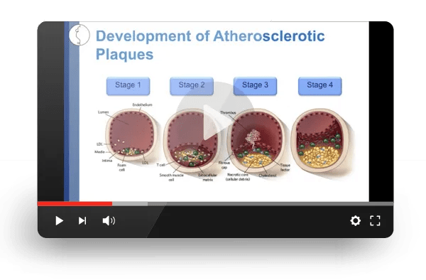 JAX Webinar - Mouse Models for Cardiovascular Disease