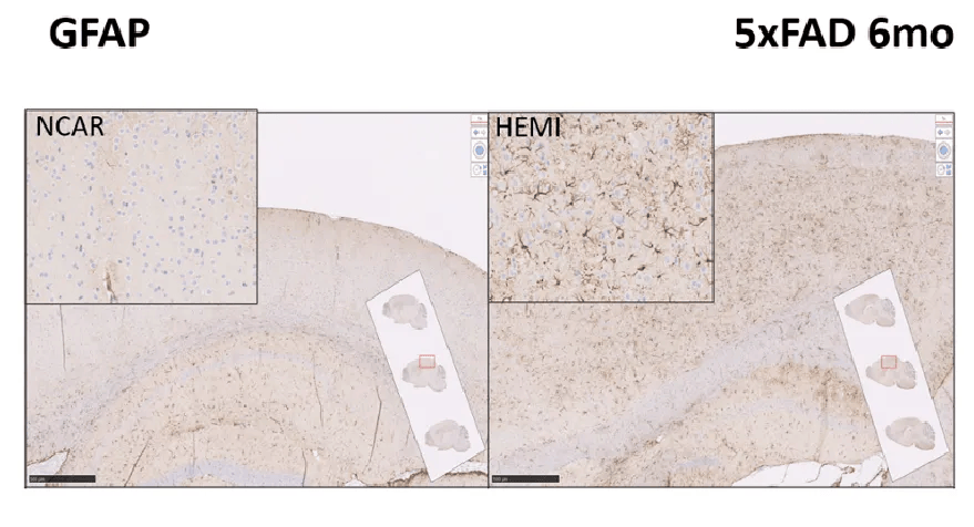 Biomarkers in 5XFAD mice are more reliable and reproducible than behavioral assays (GFAP)