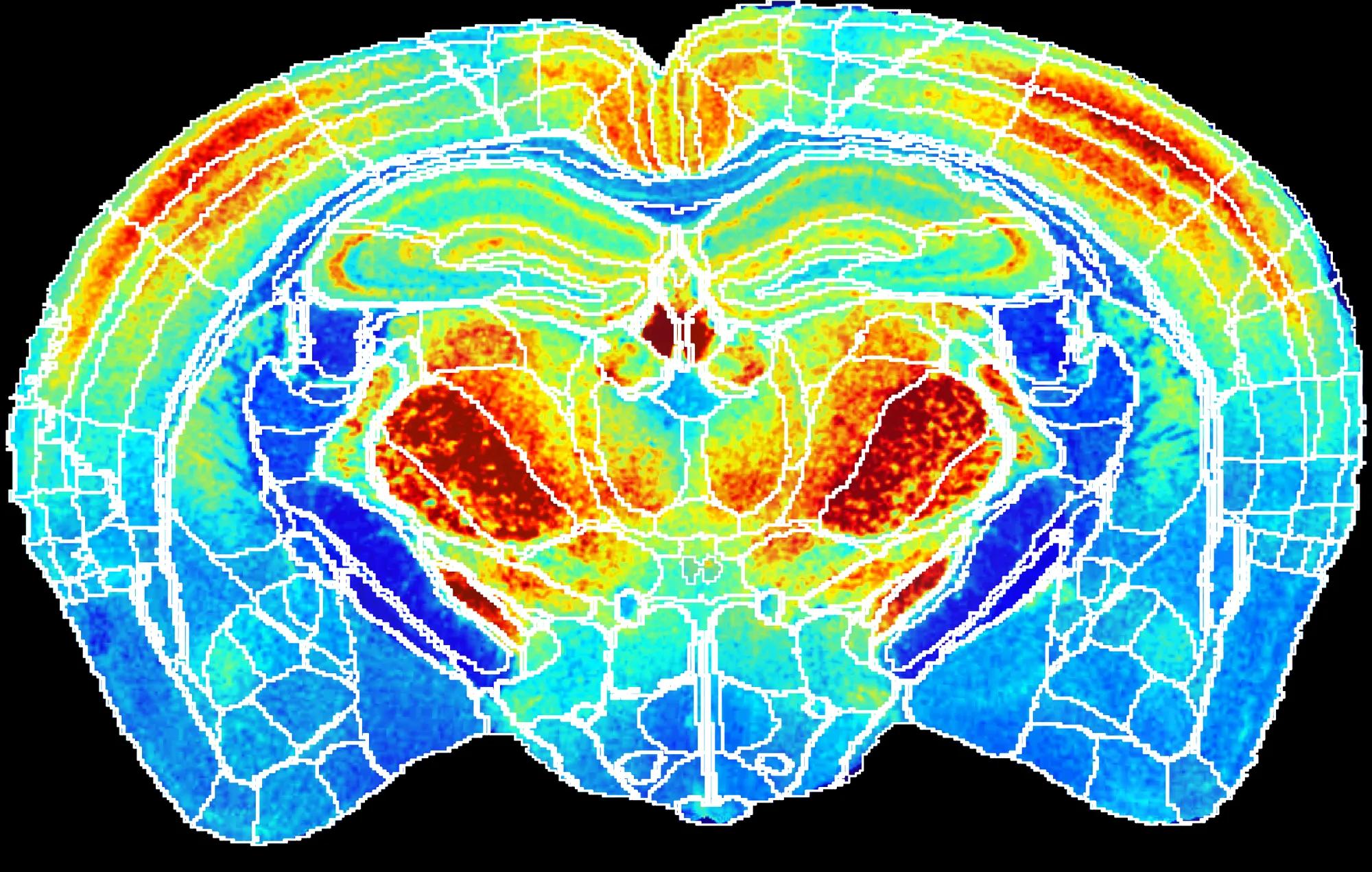This scan of a mouse brain integrates spatial transcriptomics, lipidomics, and proteomics to define the molecular architecture of the aging brain.