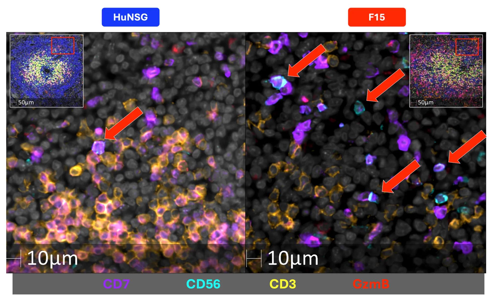 Figure 3: NK cells more readily identified in hu-F15 mice, as identified by CD7 and CD56 staining