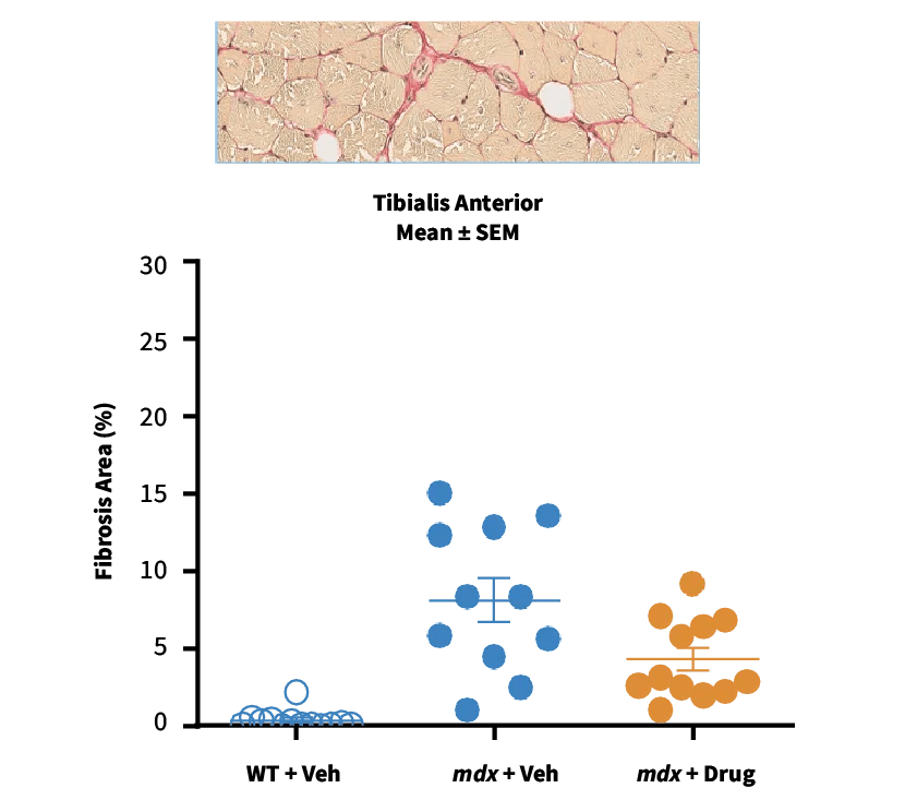 C57BL/10ScSn-Dmdmdx/J Strain #001801 - Staining of tibialis anterior to evaluate drug efficacy on fibrosis in skeletal muscle