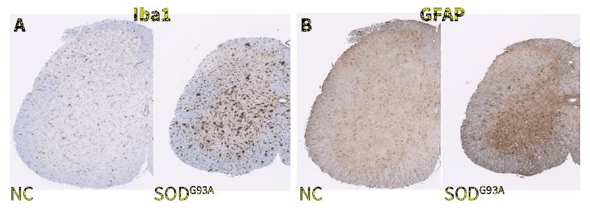 Neuroinflammation, Spinal Cord - SOD1-G93A mice show increased immunoreactivity of microglia (Iba1, A) and astrocytes (GFAP, B) in the spinal cord compared to non-carrier (NC) controls
