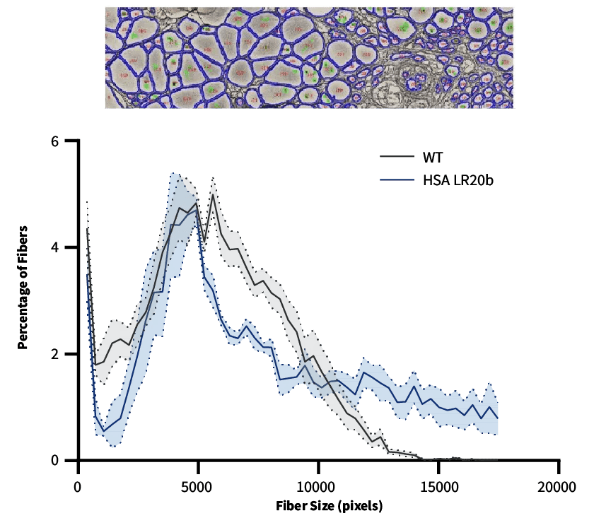 C57BL/10ScSn-Dmdmdx/J Strain #001801 - Quadriceps morphometry to evaluate drug efficacy in restoring muscle fibers