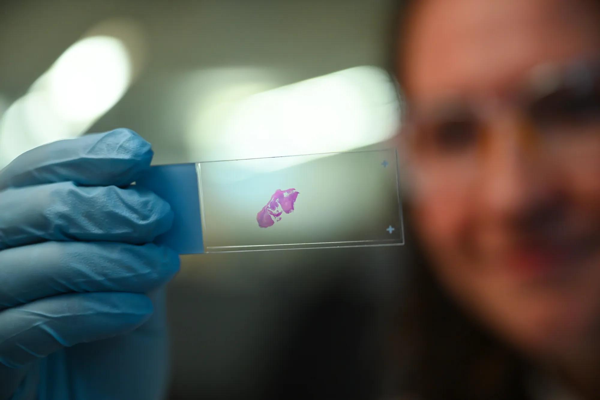 Caroline Haney, Ph.D., holds a slide containing an endometriosis lesion used for research at The Jackson Laboratory for Genomic Medicine. April 22, 2026 in Farmington, Conn. Credit: Dave Wurtzel, The Jackson Laboratory.
