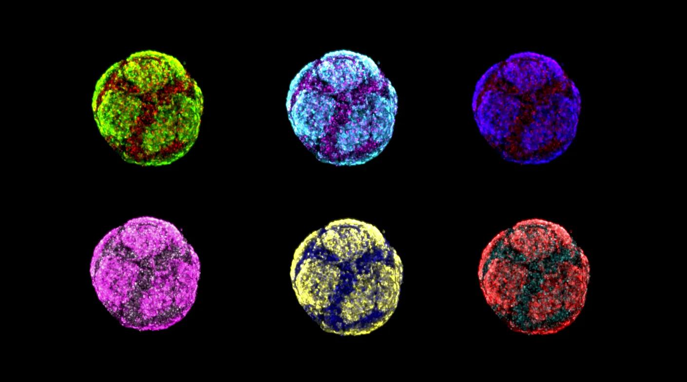 IPSC-derived pancreatic organoids imaged by Filippo Cipriani, Ph.D.